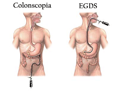 endoscopia definitivo